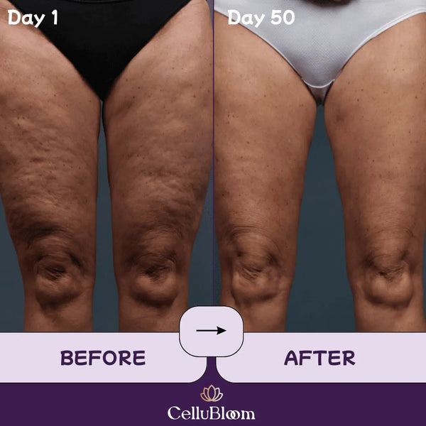 CelluBloom® - Sculpt & Tone Pro CelluBloom