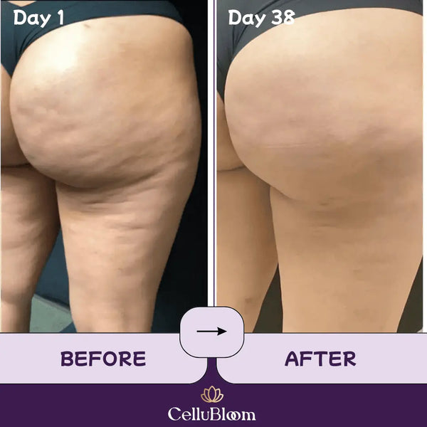 CelluBloom® - Sculpt & Tone Pro CelluBloom