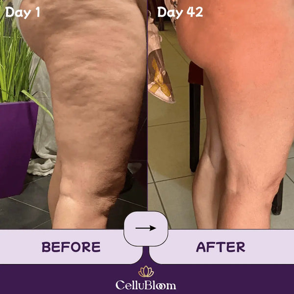 CelluBloom® - Sculpt & Tone Pro CelluBloom