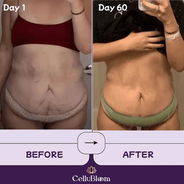 CelluBloom® - Sculpt & Tone Pro CelluBloom